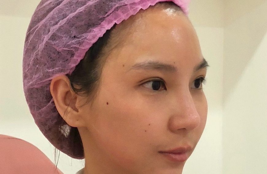 โบท็อกซ์ลิฟกรอบคอระหงษ์ (Nefertiti Botox)